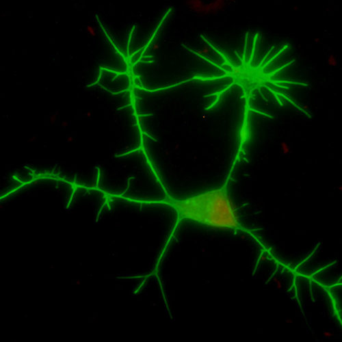 Neurobiología de la enfermedad de Parkinson