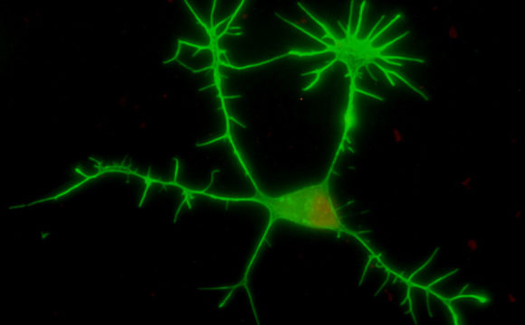 Neurobiología de la enfermedad de Parkinson