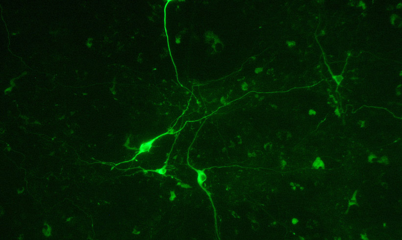 Neuronas en cultivos